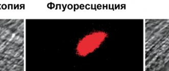 Blood clot formation