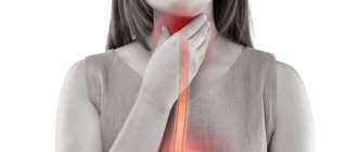 Gastroesophageal reflux disease