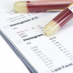 Blood hemogram - what kind of analysis is it?