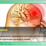 Hypoxia is a pathological condition in which oxygen deficiency occurs in the body due to its reduced supply from the outside and/or due to dysfunctional utilization in cells.