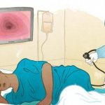 Colonoscopy: indications, preparation and procedure