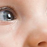 Conjunctivitis of the eyes in children