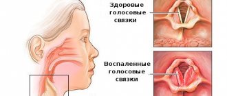 Ammonia-anise cough drops: how to take, instructions for use. How to drink for children and adults 