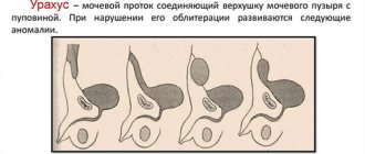 Omphalitis