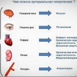 Последствия гипертензии