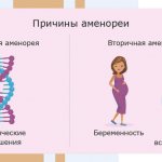 Causes of primary and secondary amenorrhea