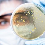 Probiotics for restoring oral microflora and treating tissue inflammation