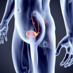Bladder cancer: symptoms and treatment
