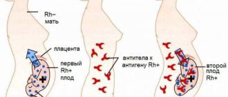 Rh conflict during re-pregnancy