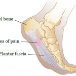 Figure 1. Plantar fascia