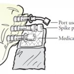 Figure 6: How to place the medication port on an alcohol pad