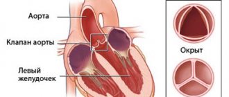 схема аортального клапана