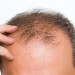 состав шампуня алерана от выпадения волос