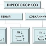 Thyrotoxicosis