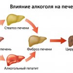 The effect of alcohol on the liver